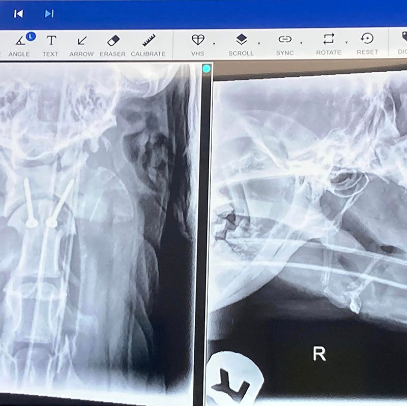 Radiographs During Surgery